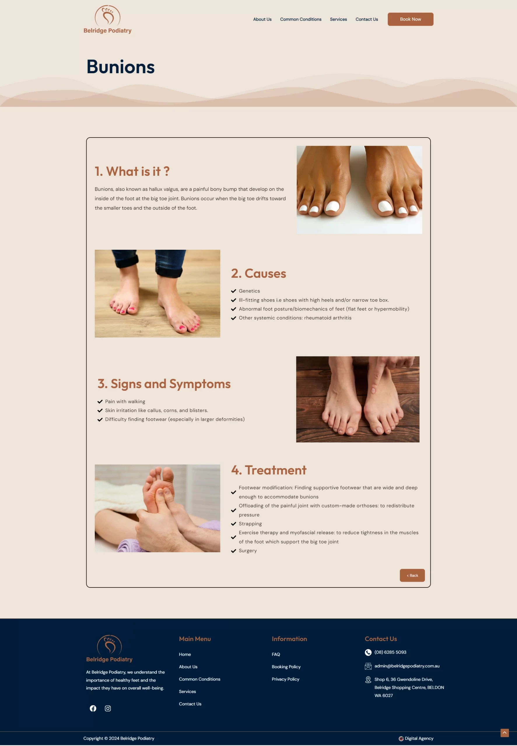 Bunions-Belridge-Podiatry